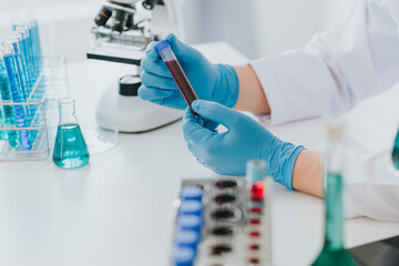 Medical equipment. Blood test.Pipette adding fluid to one of several test tubes .