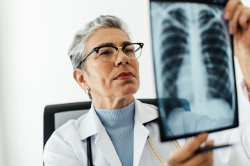 Careful examination: Doctor looks at an x-ray scan of the lungs