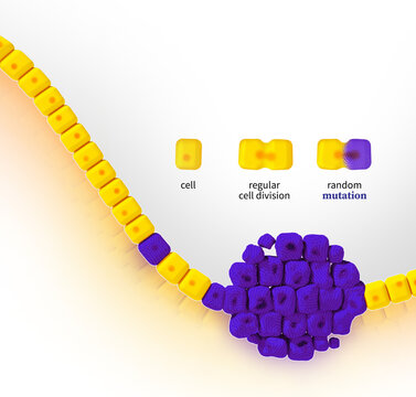 Aging and cancer, illustration