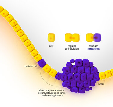 Aging and cancer, illustration