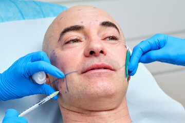 infecting botulinum toxin in the face of a man for treatment of bruxism