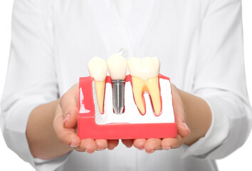 Dentist holding educational model of dental implant on white background, closeup