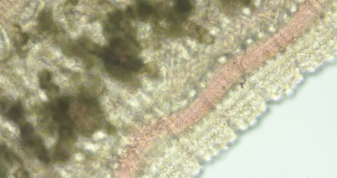 Leech family Erpobdellidae under a microscope, order Arhynchobdellida. Possibly genus Erpobdella sp. Visible muscle contraction, blood flow and structure of body surface is visible
