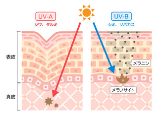 紫外線　UV-AとUV-Bの違い　肌の断面図　 - obrazy, fototapety, plakaty