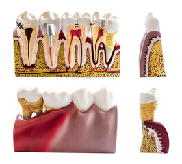 Mockup example teeth treatment