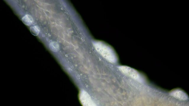 Freshwater Hydra, Hydrozoa and Infusoria Kerona polyporum, family Oxytrichidae, Trichodina under microscope. In video, they move around body of Hydra and are commensal.