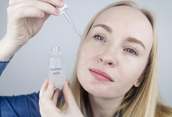 Azelaic acid. The girl applies azelainates to her face. Laboratory research. Facial skin care....
