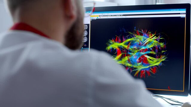 Medical hospital: neurologist use computer, analyze patient's MRI, diagnose brain. Health Clinic Lab: A professional doctor examines a functioning CT scan