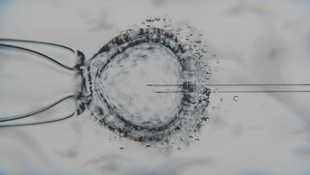 In vitro fertilization with intracytoplasmic sperm injection (ICSI) &ndash; macro view of ovum and needle