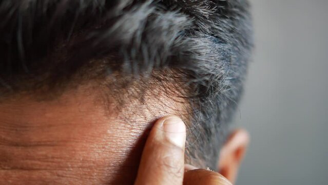 hair loss concept with man checking his hair 