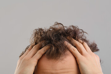 Fototapeta premium Young man with hair loss problem on grey background, closeup