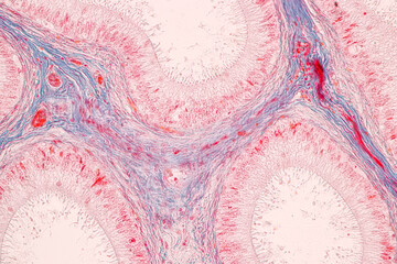Anatomy and Histological Epididymis and Testis human cells under microscope.