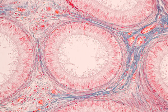 Anatomy and Histological Epididymis and Testis human cells under microscope.