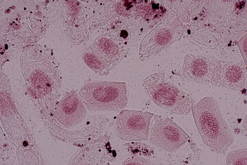 Root tip of Onion and Mitosis cell in the Root tip of Onion under a microscope.	