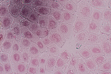 Root tip of Onion and Mitosis cell in the Root tip of Onion under a microscope.	