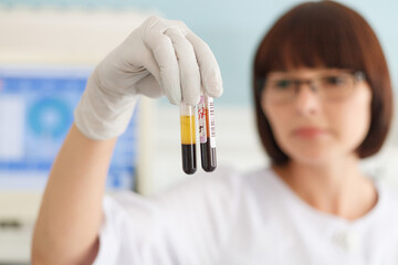 Female lab scientist researcher technician holding test tube blood sample in focus in lab