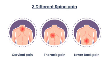 Vector illustration of spine pain. body point pain. different types of spine pain. medical infographics concept. vector illustration.