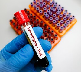 Blood sample for Lamotrigine test. Test done to Monitor the concentration of lamotrigine in blood...