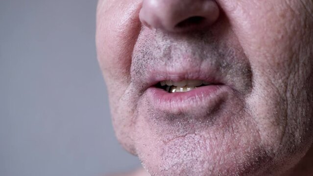 Close up, Smiling Elderly Male Pensioner with False Dentures and Golden Teeth. Wrinkled, unshaven face of an old man with white dental implants, and an artificial upper jaw in mouth. Part of face.