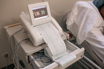 Cardiotocograph near patient in ward