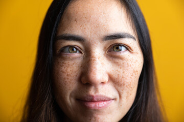 Woman crosses her eyes