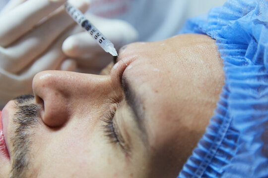 Doctor applying botox to patient's face