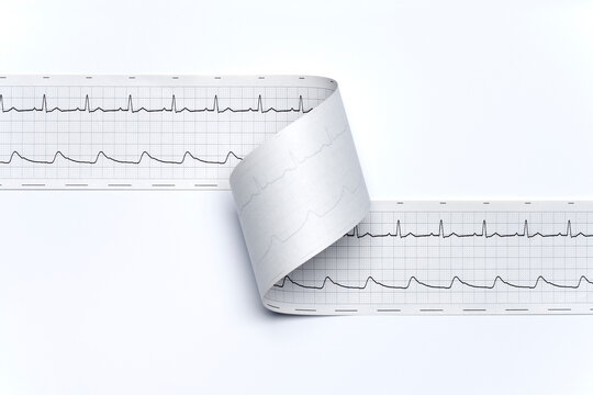 Regular print out elektrocardiogram, ecg, on white background close up 