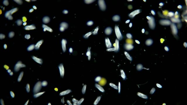 Infusorium colony Ciliophora Hypotrichia and Coleps under a microscope, Class Spirotrichea and Prostomatea. Planktonic organism.