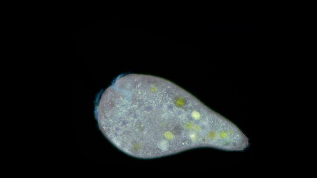 Stentor Ciliophora Infusoria under microscope, family Stentoridae, class Ciliata, order Heterotrichida, feed on small organic residues, bacteria, algae, protozoa.