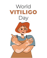 girl with vitiligo. Love yourself. Banner for international Vitiligo Day. White background.
