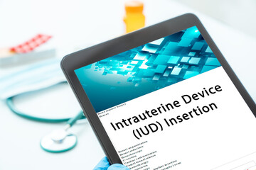 Intrauterine Device (IUD) Insertion medical procedures A procedure that involves inserting a small, T-shaped device into the uterus to prevent pregnancy.