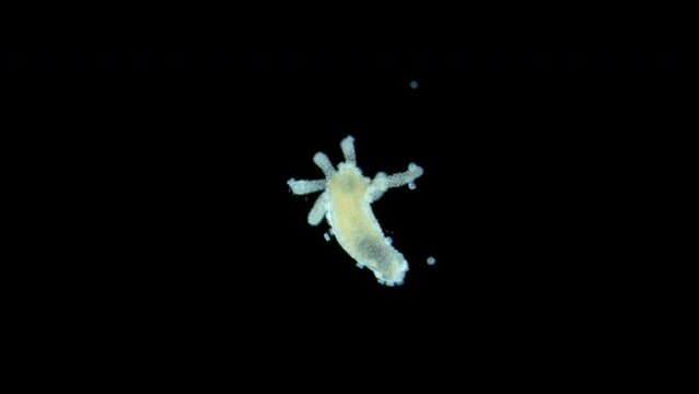Freshwater Hydra, Hydrozoa and Infusoria Trichodina under microscope, Family Trichodinidae. In video, they move around body of Hydra and are commensal.