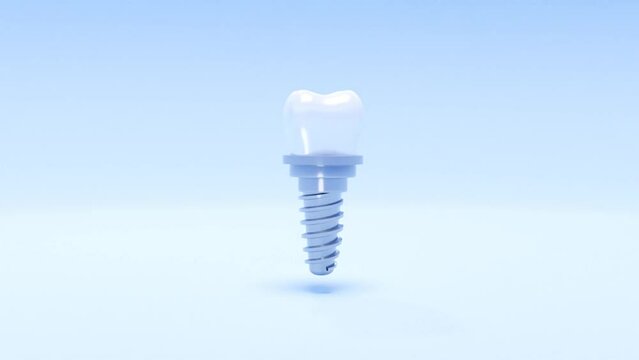 3d tooth implant animation. Isolated rotating 3d tooth implant model. Soaring beautiful white dental 3d rendering. Blue background. Tooth human implants