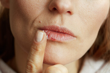 Female applying ointment using finger on beige