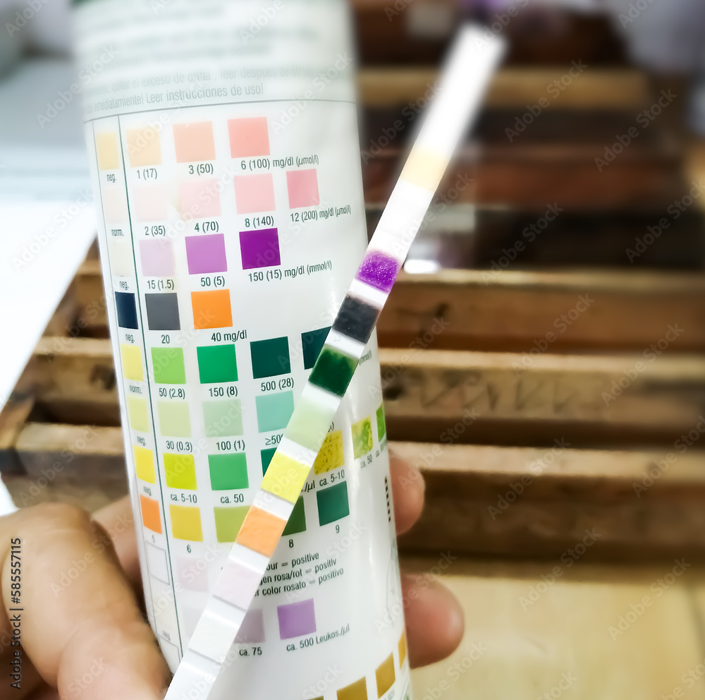 Poster doctor doing urine analysis by urine strip.