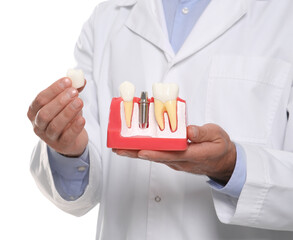 Dentist holding educational model of dental implant on white background, closeup