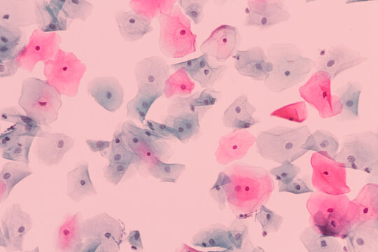 View in microscopic of normal human cervix cells.Squamous epithelial cells.Photo of Human skin cells.Superficial and intermediate epithelial cells.Cytology and pathology laboratory department.