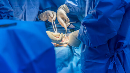 Doctor or surgeon did surgery of hernia mesh repair operation inside operating room in hospital. Open repair of inguinal hernia in groin mass patient.Medical mesh device was use with blur background. - obrazy, fototapety, plakaty