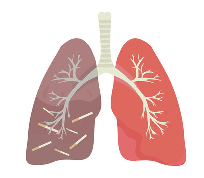Healthy and sick human lungs with trachea illustration
