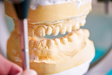 dental prosthetic plaster teeth,  dental braces