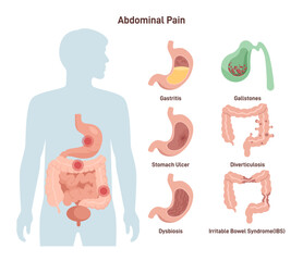 Abdominal ache. Medical infographic of different abdominal organ