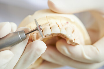 Fototapeta na wymiar Dentures being trimmed with a dental drill piece 