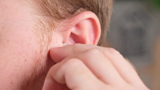 A man inserts earplugs in his ears so as not to hear extraneous noise, music, snoring. Silicone earplugs for sleeping.