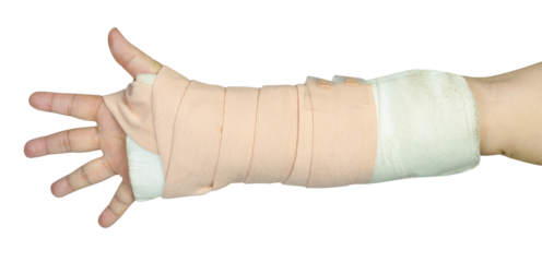 Hand making physical therapy to broken wrist from accident isolated