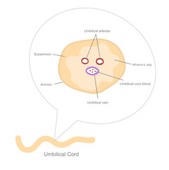 The Umbilical cord structure that shows the important component in cross section view : Umbilical arteries and vein, subamnion, amnion, cord blood and Wharton's jelly.