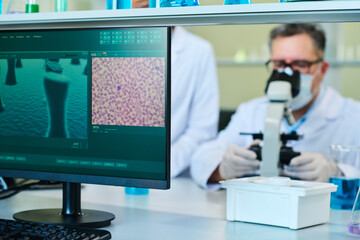 Focus on computer monitor with part of virus cell on screen against male virologist studying bacteria in microscope by his workplace