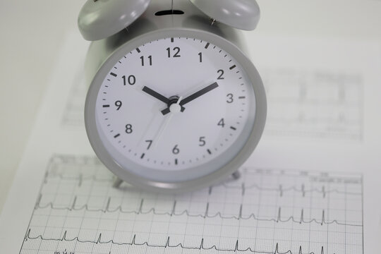 Alarm clock stands on cardiogram papers on table in hospital