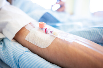 Venous catheter on a patient before an operation.