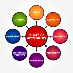 Stages of appendicitis (inflammation of the appendix), mind map concept for presentations and reports