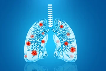 Tuinposter Virus infected lungs. Pneumonia virus, covid illnes, infectious micro virology. 3d illustration © Crystal light